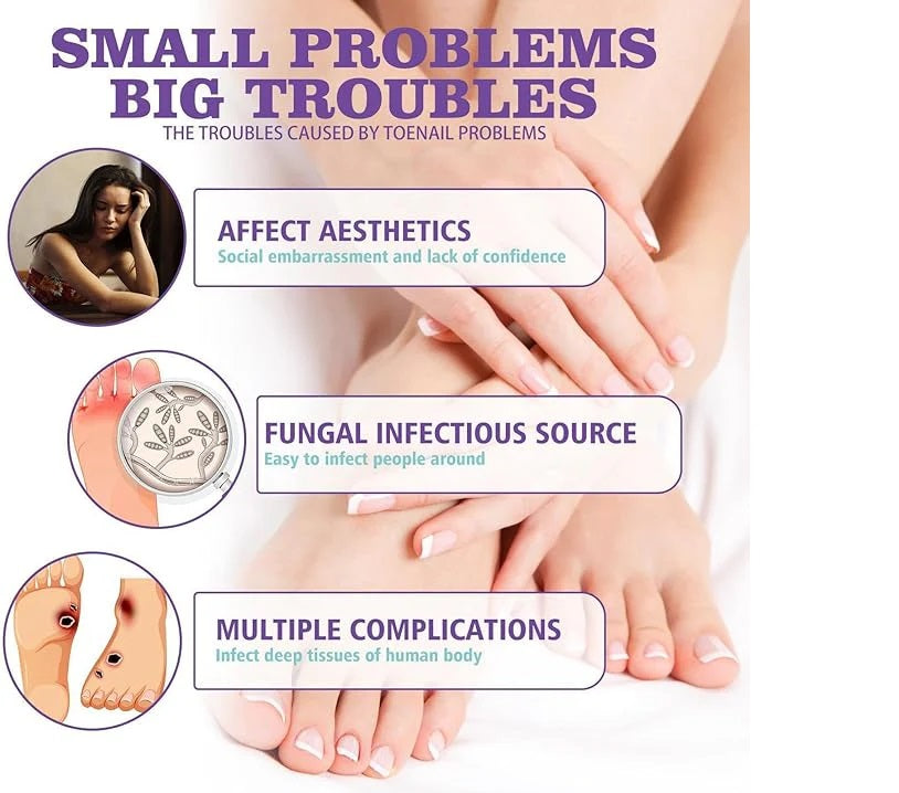 Nail Fungus Spray