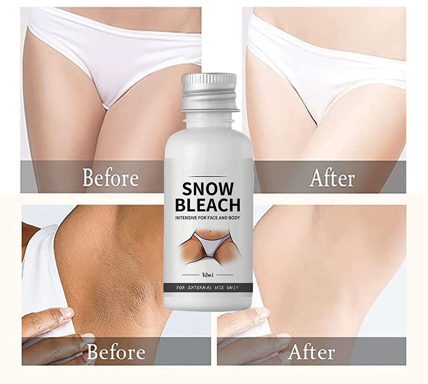 Dark Spot Remover Cream (30ml) كريم إزالة البقع الداكنة