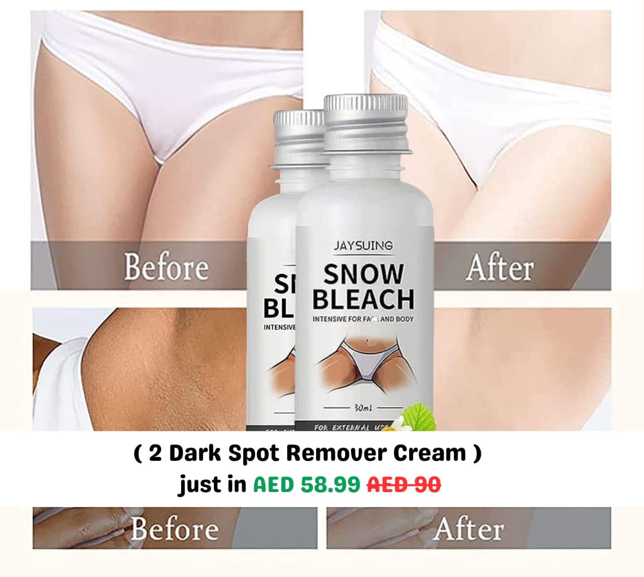 Dark Spot Remover Cream (30ml) كريم إزالة البقع الداكنة